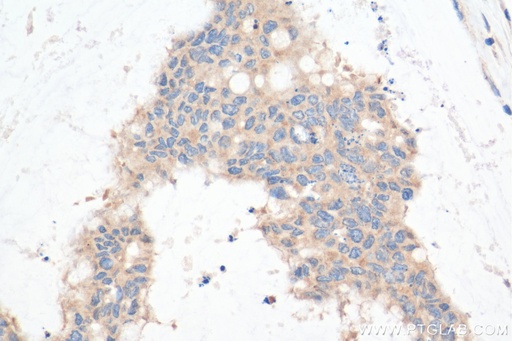 [11842-1-AP-150UL] STBD1 Polyclonal antibody
