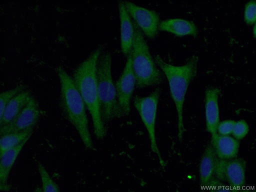 [11843-1-AP-20UL] RBP5 Polyclonal antibody