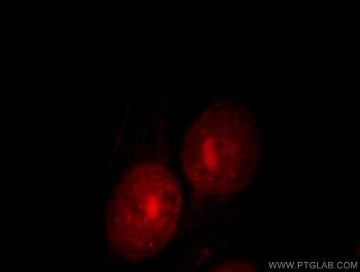 [11844-1-AP-20UL] UBE2E2 Polyclonal antibody
