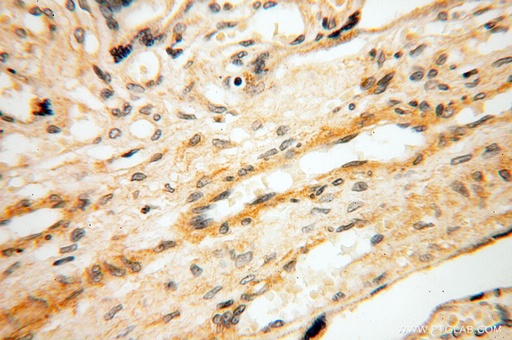 [11845-1-AP-20UL] SRPX2 Polyclonal antibody