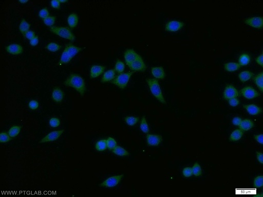 [11847-1-AP-20UL] SPCS1 Polyclonal antibody
