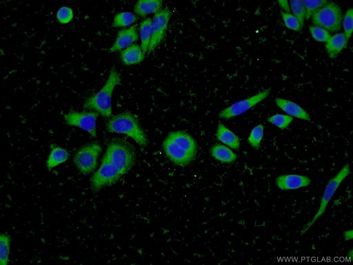 [11848-1-AP-150UL] Cofilin 2 Polyclonal antibody