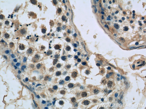 [11849-1-AP-150UL] SPATA6 Polyclonal antibody