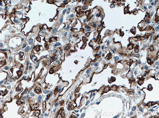 [11850-1-AP-20UL] SFTPA1 Polyclonal antibody