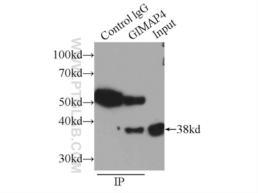 [11852-1-AP-150UL] GIMAP4 Polyclonal antibody