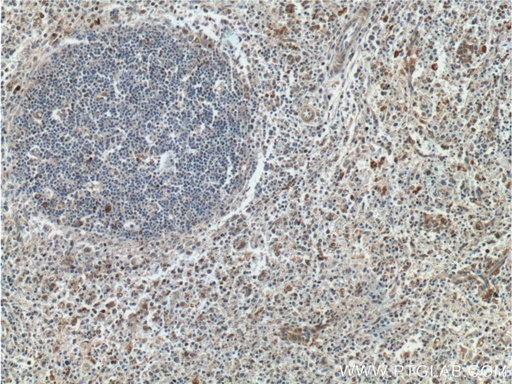 [11854-1-AP-150UL] GBP2 Polyclonal antibody