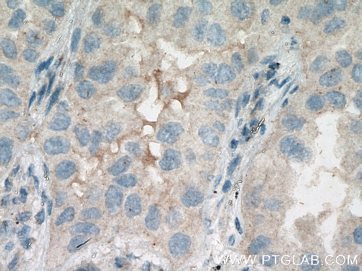 [11855-1-AP-20UL] HSD17B6 Polyclonal antibody