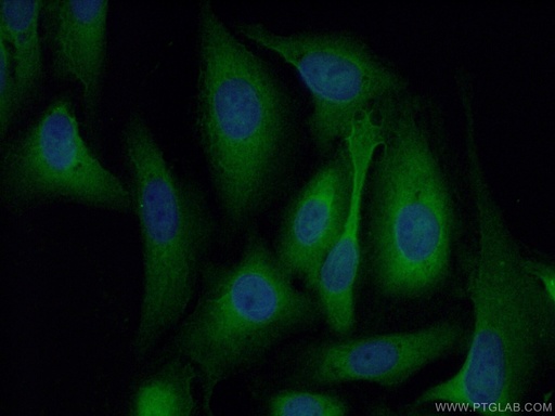[11858-1-AP-20UL] Galectin-1 Polyclonal antibody