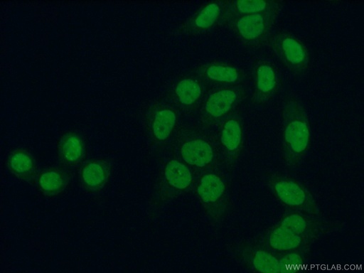 [11859-1-AP-150UL] BRD3 Polyclonal antibody