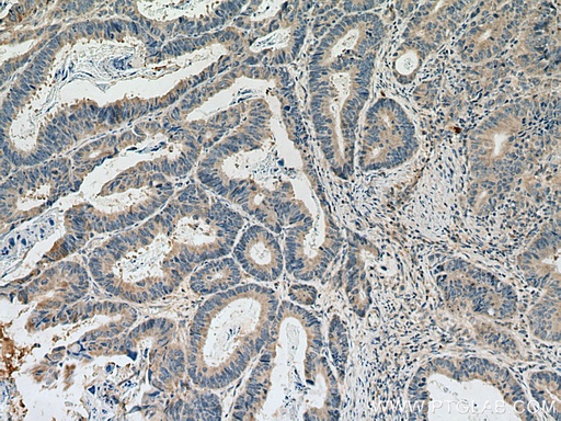 [11860-1-AP-20UL] DLEU1 Polyclonal antibody
