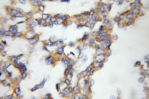[11861-1-AP-20UL] RAMP3 Polyclonal antibody