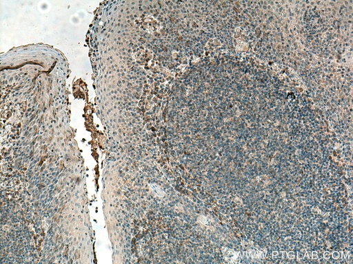 [11863-1-AP-20UL] IL-37 Polyclonal antibody