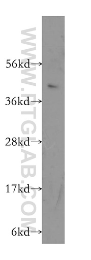 [11864-1-AP-150UL] MS4A7 Polyclonal antibody
