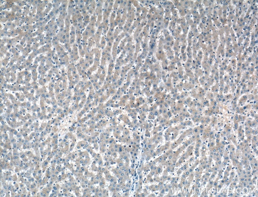 [11865-1-AP-150UL] ADAMTS4 Polyclonal antibody