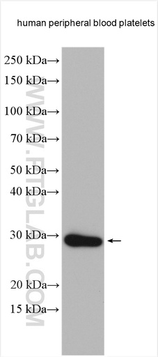 [11866-1-AP-150UL] RGS18 Polyclonal antibody