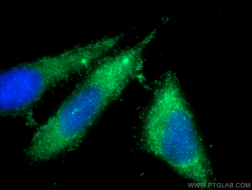 [11867-1-AP-150UL] Ficolin-3 Polyclonal antibody