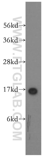 [11868-1-AP-150UL] SH2D1A Polyclonal antibody