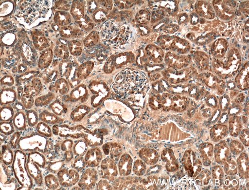 [11870-1-AP-20UL] VPS37A Polyclonal antibody