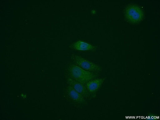 [11874-1-AP-20UL] HNMT Polyclonal antibody