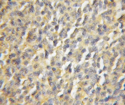 [11878-1-AP-20UL] TTC4 Polyclonal antibody