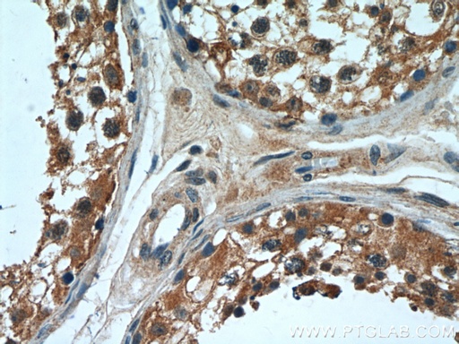 [11879-1-AP-20UL] OSBPL9 Polyclonal antibody