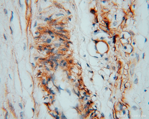 [11883-1-AP-150UL] CSHL1 Polyclonal antibody