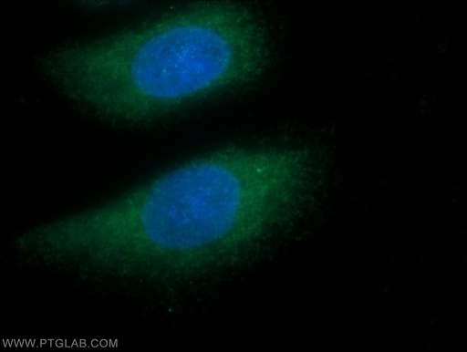 [11884-1-AP-150UL] GNGT1 Polyclonal antibody