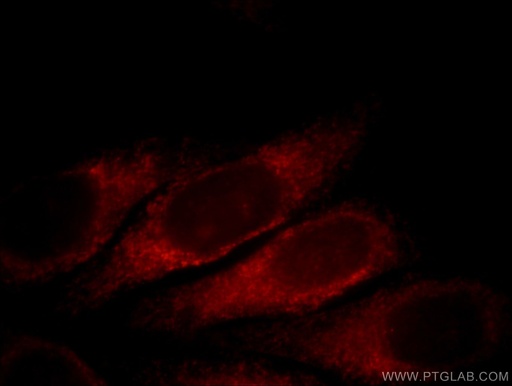 [11885-1-AP-20UL] SLC4A4 Polyclonal antibody