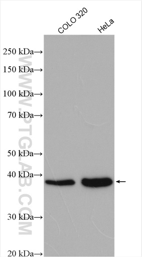 [11888-1-AP-150UL] XLF Polyclonal antibody