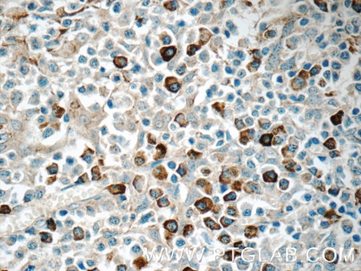 [11890-1-AP-20UL] TRA Polyclonal antibody