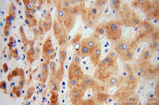 [11891-1-AP-20UL] Prealbumin/transthyretin Polyclonal antibody