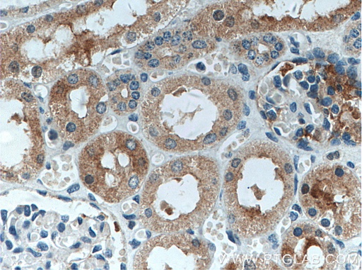 [11893-1-AP-20UL] MIB1 Polyclonal antibody