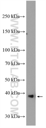 [11894-1-AP-20UL] GRAP2 Polyclonal antibody