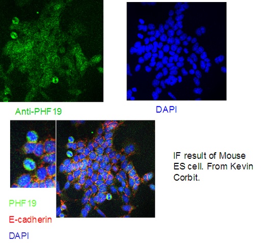 [11895-1-AP-150UL] PHF19 Polyclonal antibody