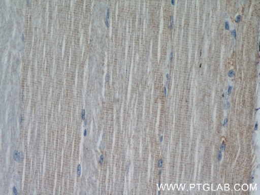 [11896-1-AP-20UL] XIRP2 Polyclonal antibody