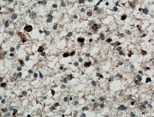 [11899-1-AP-150UL] TERF1 Polyclonal antibody