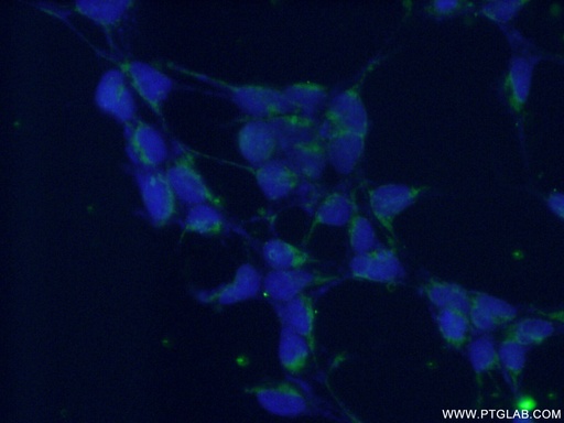 [11900-1-AP-20UL] DGKE Polyclonal antibody