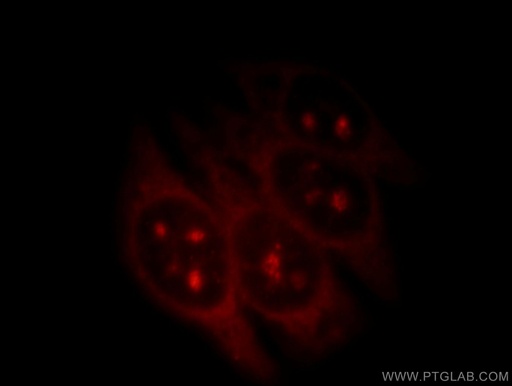 [11905-1-AP-150UL] RNF7 Polyclonal antibody