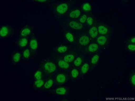 [11908-1-AP-150UL] ATF2 Polyclonal antibody