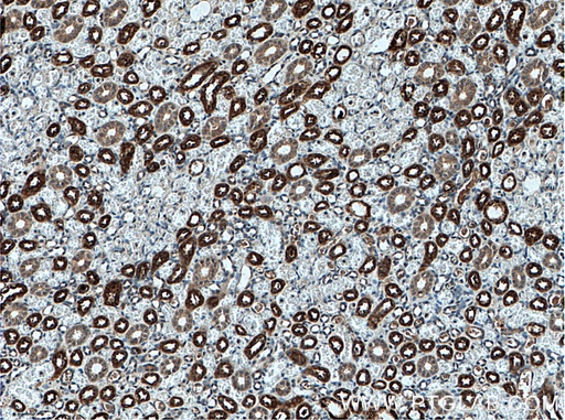 [11911-1-AP-150UL] Uromodulin Polyclonal antibody