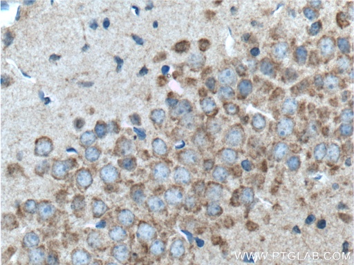 [11912-1-AP-150UL] GPR125 Polyclonal antibody