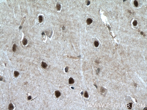 [11914-1-AP-20UL] PLRG1 Polyclonal antibody