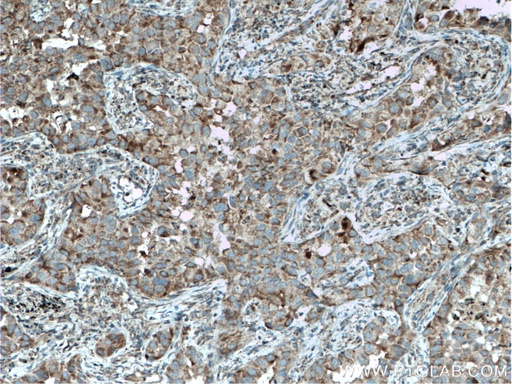 [11920-1-AP-20UL] ST2 Polyclonal antibody