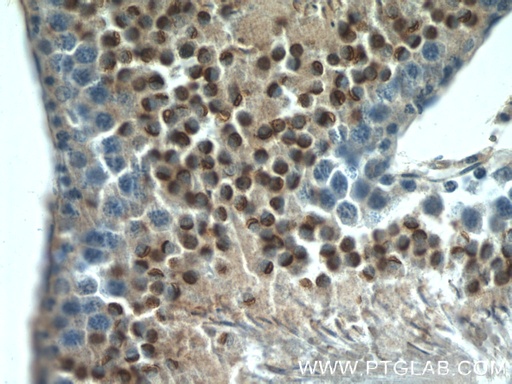[11922-1-AP-150UL] LYZL6 Polyclonal antibody