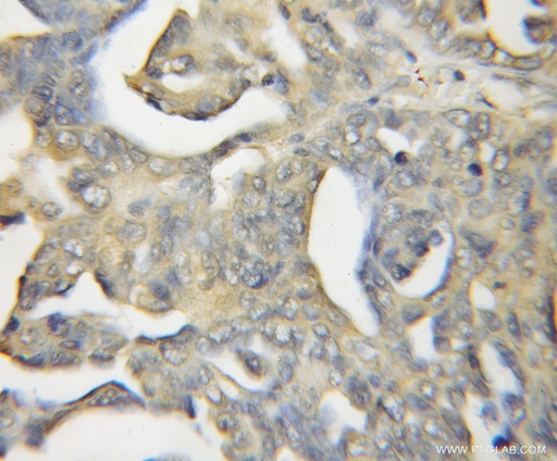 [11924-1-AP-150UL] Calcyphosine 2 Polyclonal antibody
