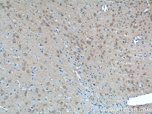 [11925-1-AP-20UL] AP3M2 Polyclonal antibody