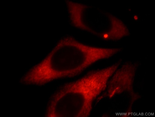 [11926-1-AP-20UL] Kininogen 1 Polyclonal antibody