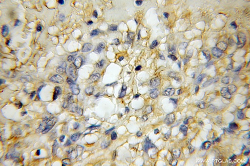 [11929-1-AP-150UL] GPR137 Polyclonal antibody