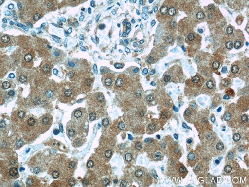 [11932-1-AP-20UL] PRAP1 Polyclonal antibody