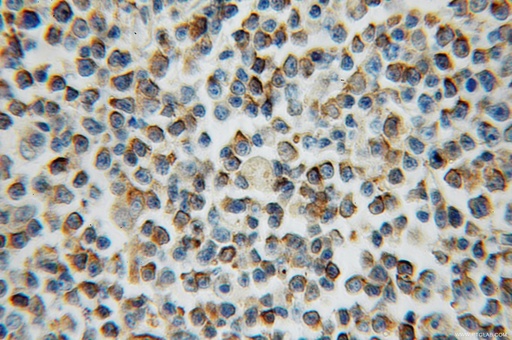 [11934-1-AP-20UL] ARL15 Polyclonal antibody